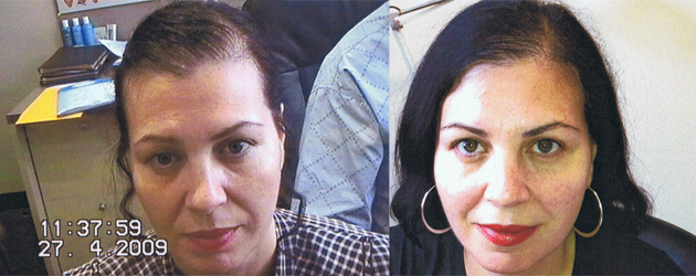Maree Azzopardi before and after hair photo